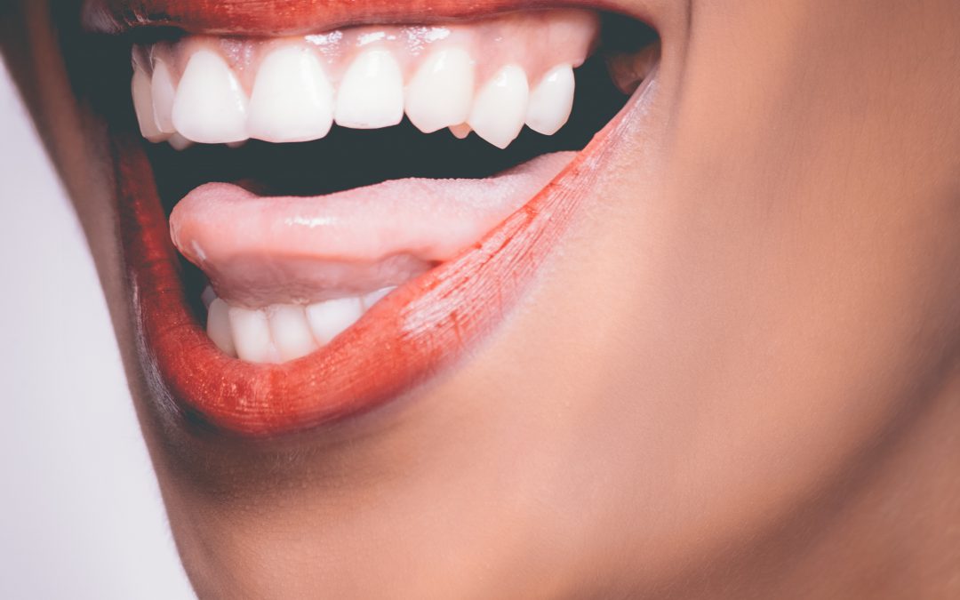 Is tanden bleken een veilige keuze?